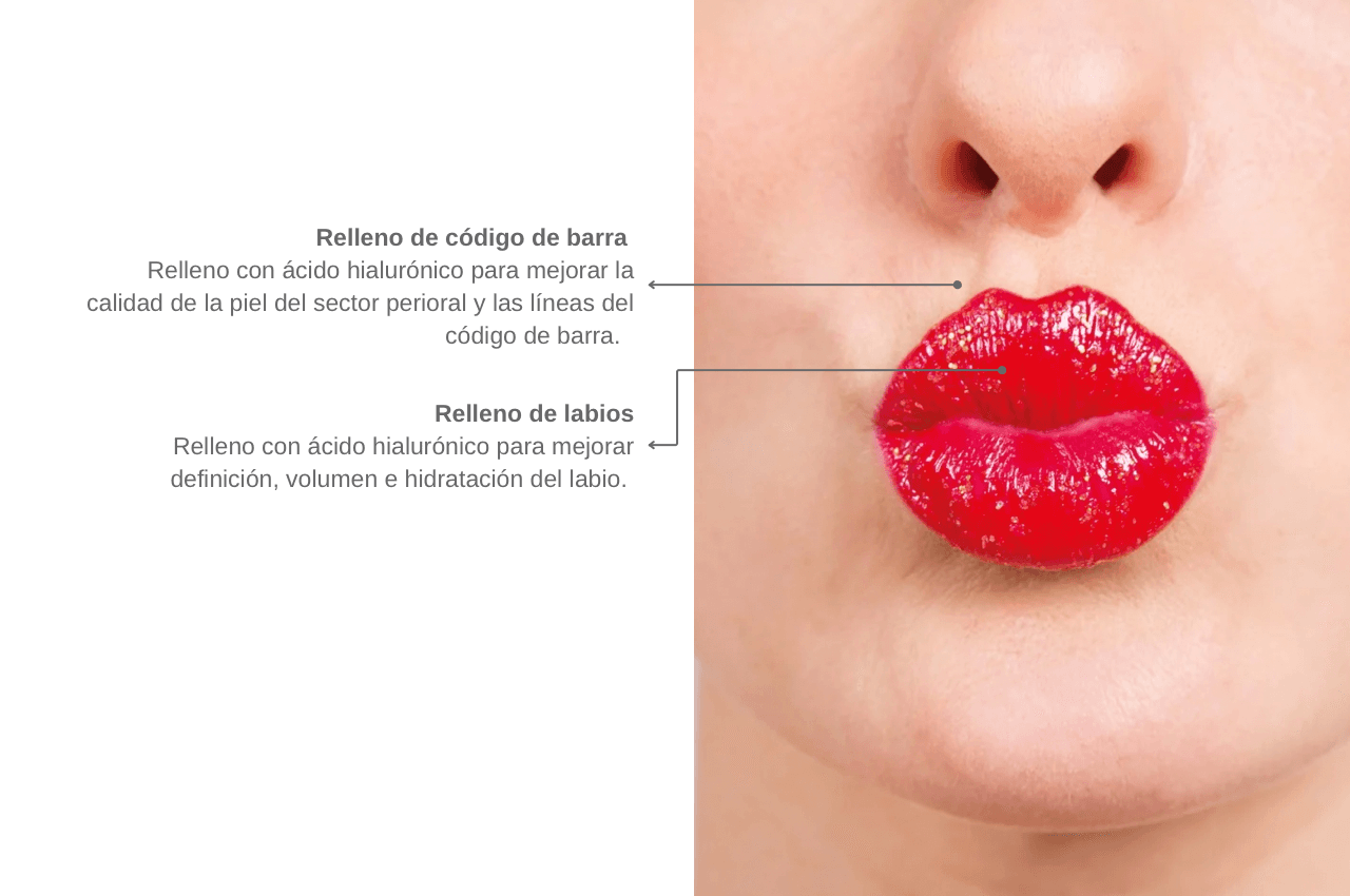 Rinomodelación sin cirugía en Clínica Dental Torrealba